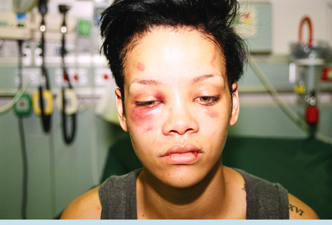 Every Time Chris Brown Starts Whining "Woe Is Me," Take A Look At This Of | The Gun