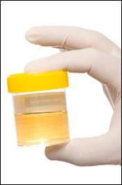 Urine Test